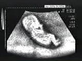 Babyrennfahrer